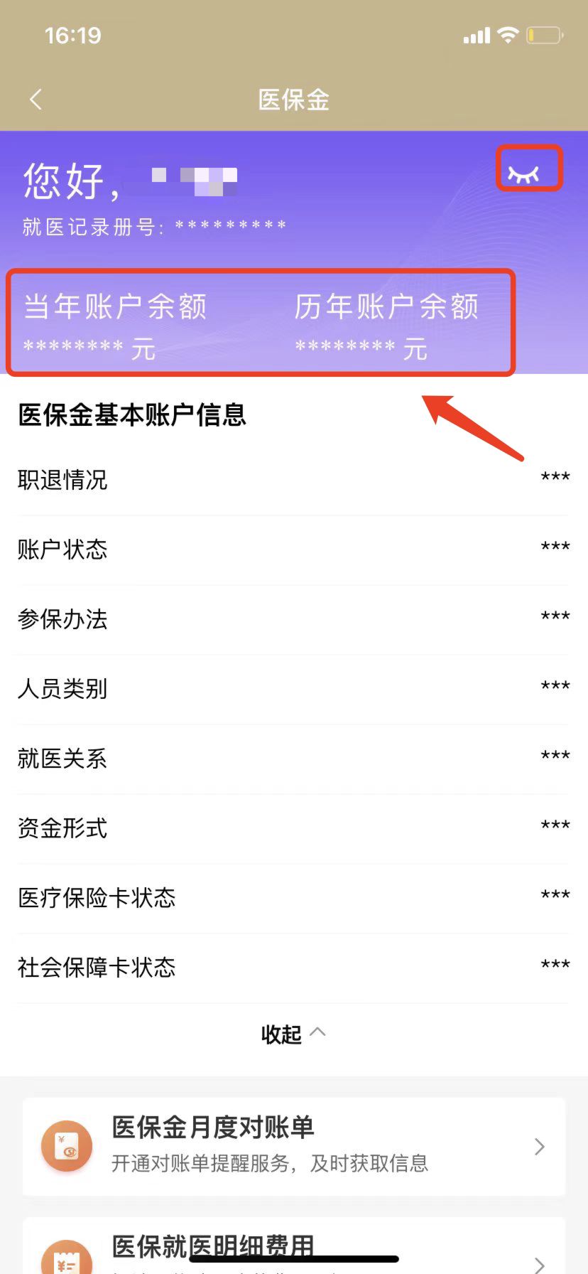 宁波最新钱转到医保卡里还能取出来吗方法分析(最方便真实的宁波医保的钱转到银行卡方法)